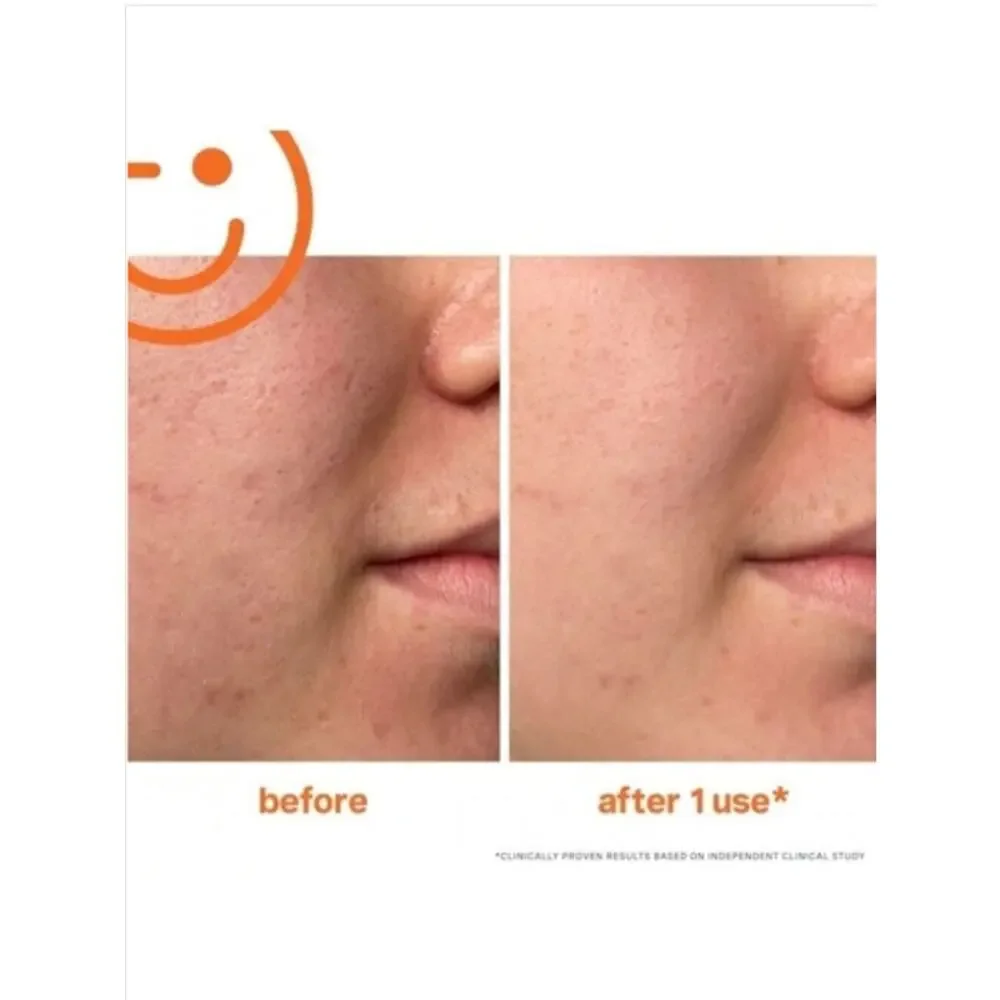💙 5/$25 Beauty · Kate Somerville ExfoliKate Intensive